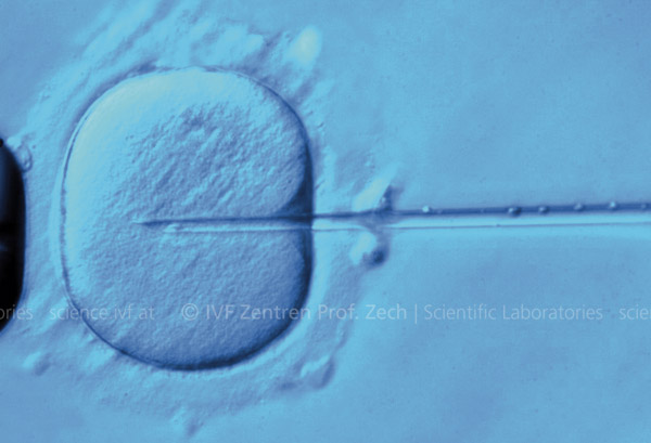ICSI / Künstliche Befruchtung